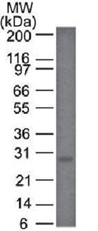 Bcl-2 (Apoptosis & Follicular Lymphoma Marker) Antibody
