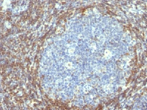 BCL2 Antibody