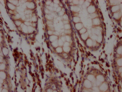 BCL2 Recombinant Monoclonal Antibody