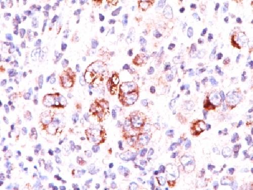 BCL2L1 Antibody