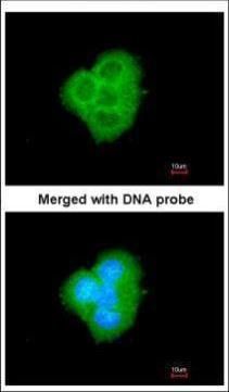 BCL2L10 Rabbit Polyclonal Antibody