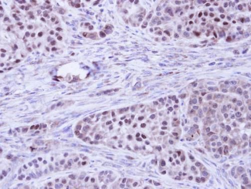 BCL2L10 Rabbit Polyclonal Antibody