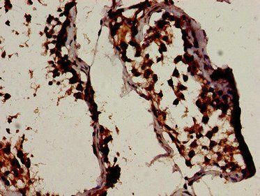 BCL2L11 Antibody