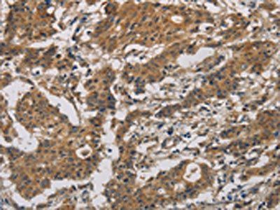 BCL2L12 Antibody