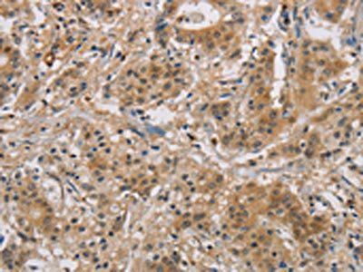 BCL2L12 Antibody