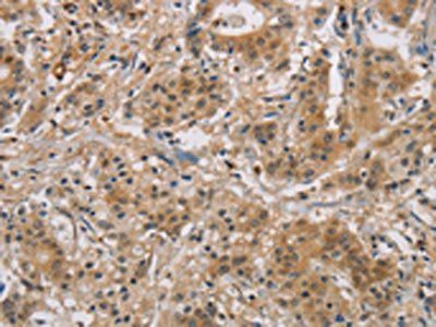 BCL2L12 antibody