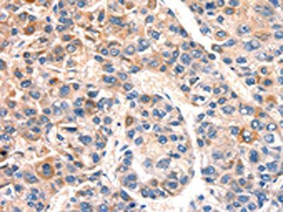 BCL3 antibody