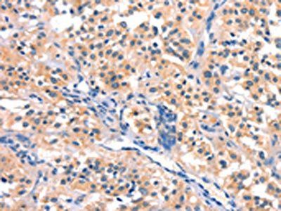 BCL3 Antibody