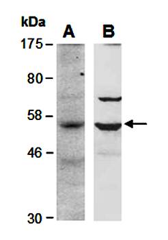 BCL6B antibody