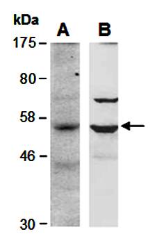 BCL6B antibody