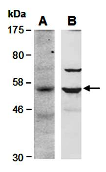 BCL6B antibody pair