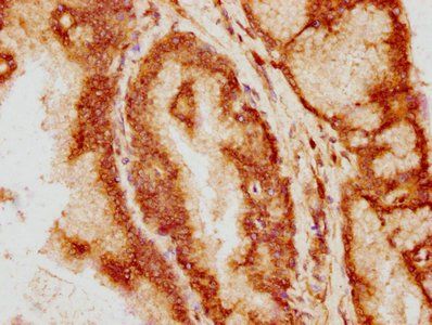 BCL9 Antibody