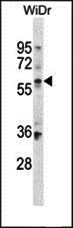 BCMO1 antibody