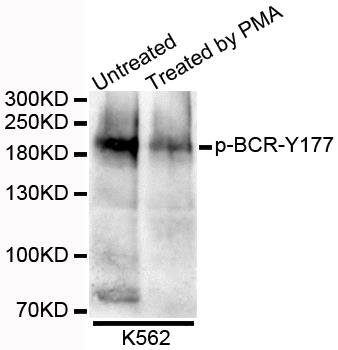 BCR (Phospho-Y177) antibody