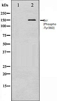 Bcr (Phospho-Tyr360) antibody