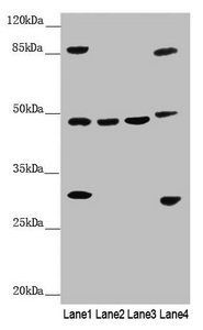 BCS1L antibody