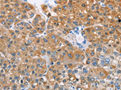 BDH1 Antibody