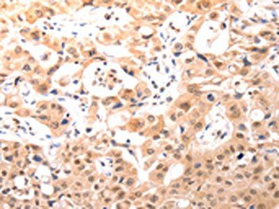 BDKRB2 antibody