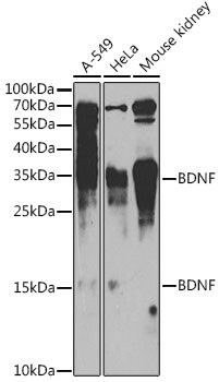 BDNF antibody