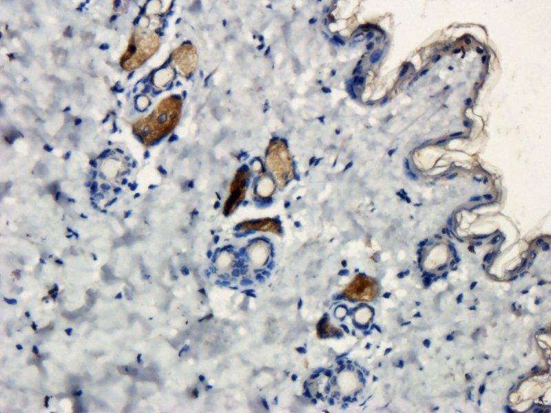 BDNF Rabbit Polyclonal Antibody