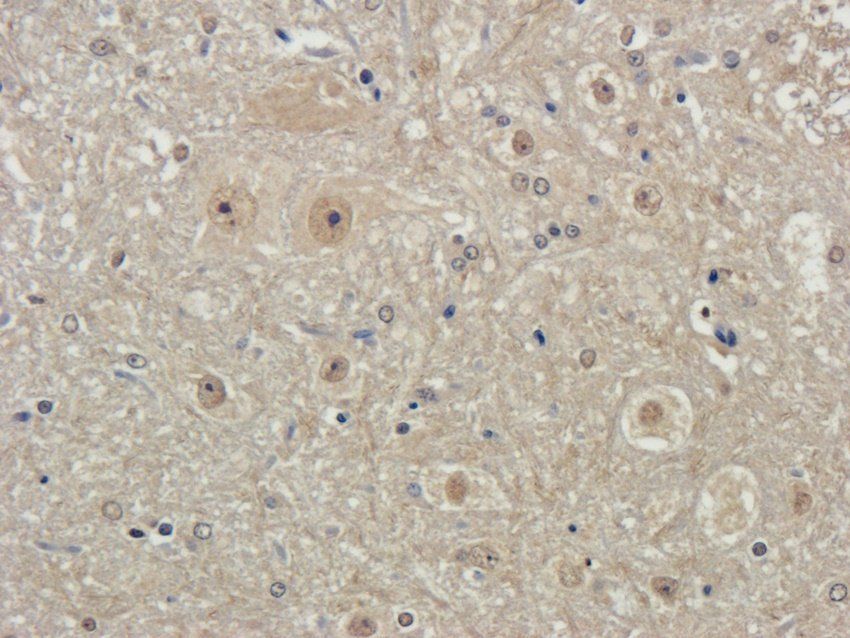 Beclin 1 antibody