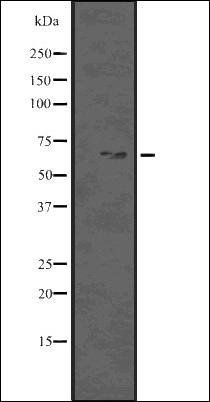 Beclin 1 (Phospho-Ser93/96) antibody