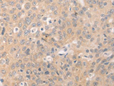 BEST1 antibody