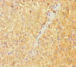 Beta-1, 4-galactosyltransferase 3 antibody