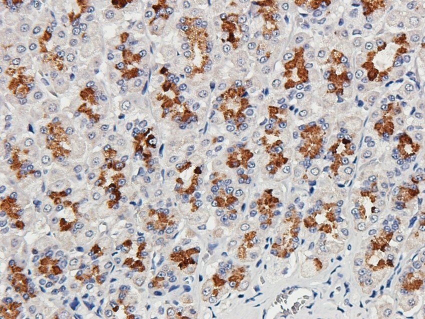 beta 1 Adrenergic Receptor Rabbit Polyclonal Antibody