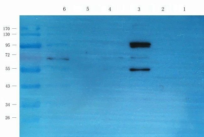 beta 1 Adrenergic Receptor Rabbit Polyclonal Antibody