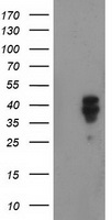 beta Catenin (CTNNB1) antibody