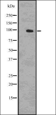 beta-Catenin (Phospho-Ser33/37/Thr41) antibody
