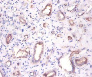ENO3 Antibody