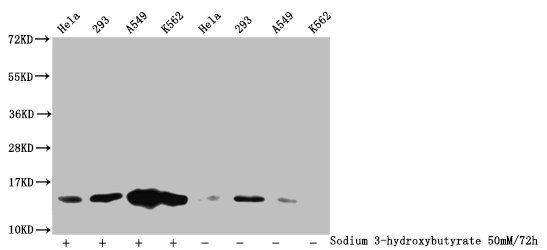 β-hydroxybutyryl-HIST1H2BC (K11) Antibody