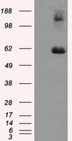 beta III Tubulin Antibody