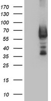 beta IV Tubulin Antibody
