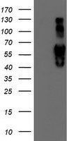 beta IV Tubulin (TUBB4A) antibody