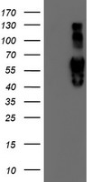 beta IV Tubulin Antibody