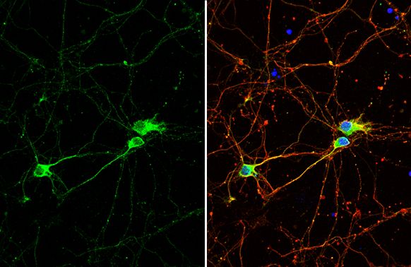 beta Tubulin 4 Rabbit Polyclonal Antibody