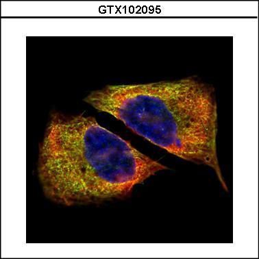 beta Tubulin 4 Rabbit Polyclonal Antibody