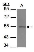 beta Tubulin 4 Rabbit Polyclonal Antibody