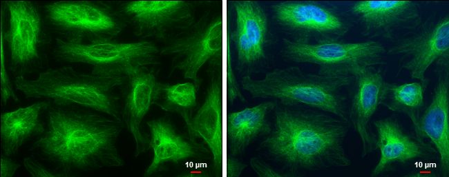 beta Tubulin Rabbit Polyclonal Antibody