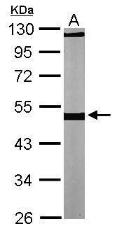 beta Tubulin Rabbit Polyclonal Antibody