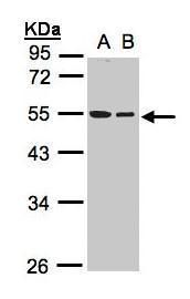 beta Tubulin Rabbit Polyclonal Antibody