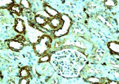 beta Actin Rabbit Polyclonal Antibody