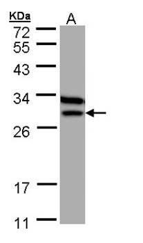 Beta-ETF antibody