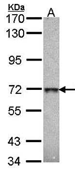 beta-Gal antibody
