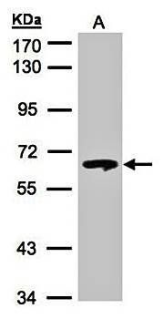 beta-glucosidase antibody