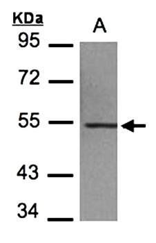 beta IV Tubulin antibody