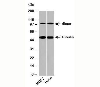 Beta Tubulin Antibody Loading Control